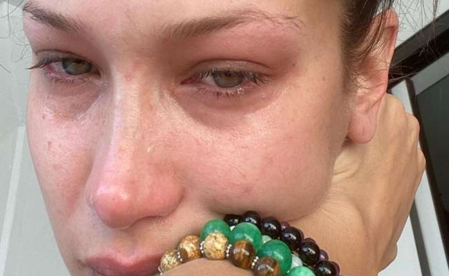 Bella Hadid says about the panic train of depression: solutions for mental health